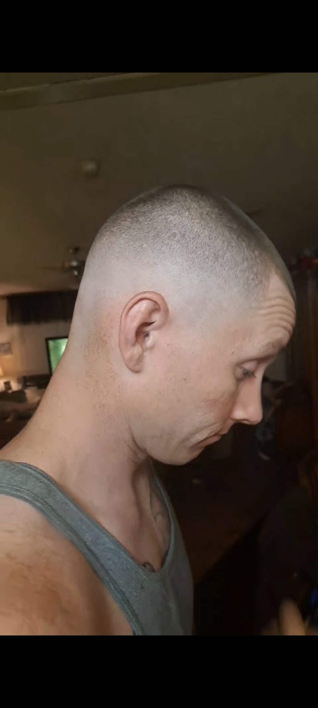 Bald fade